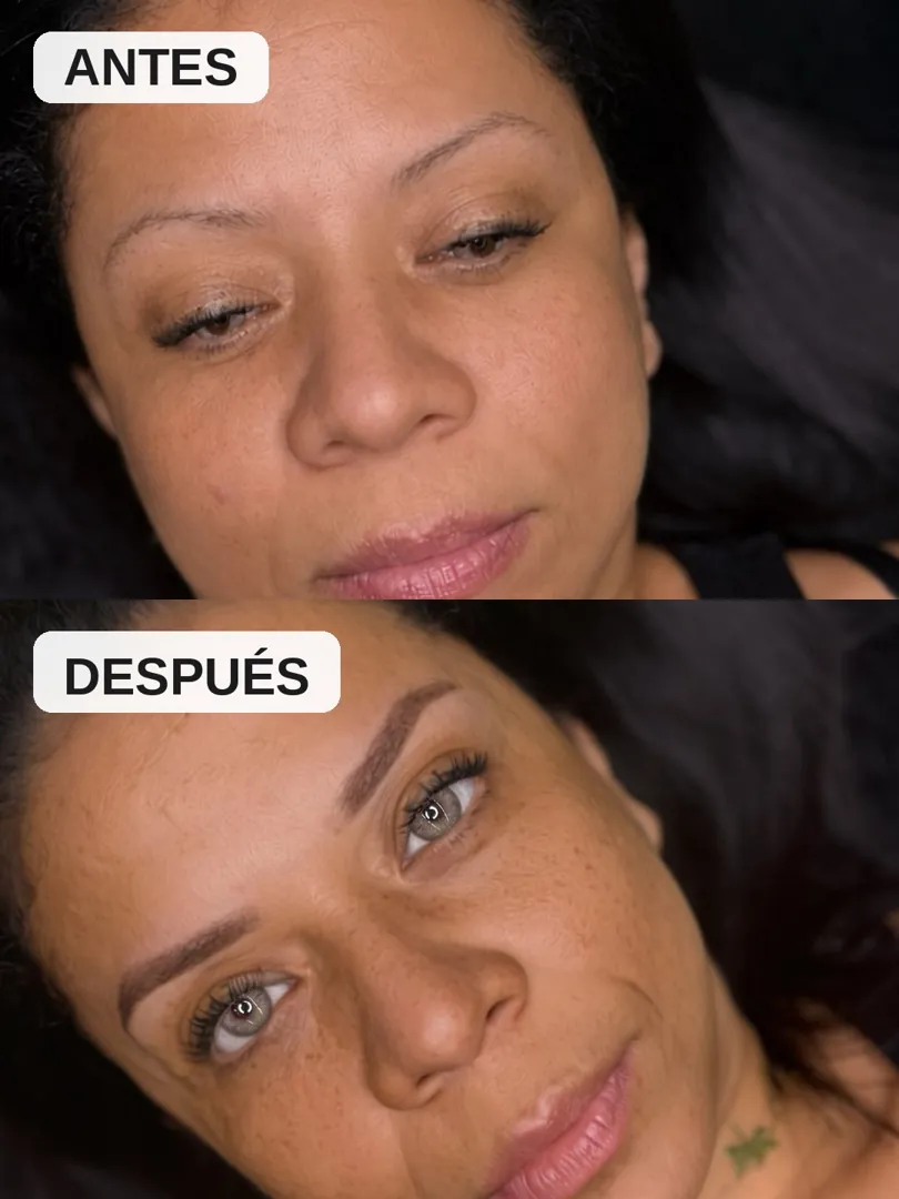 Antes y después de cejas, clienta 2