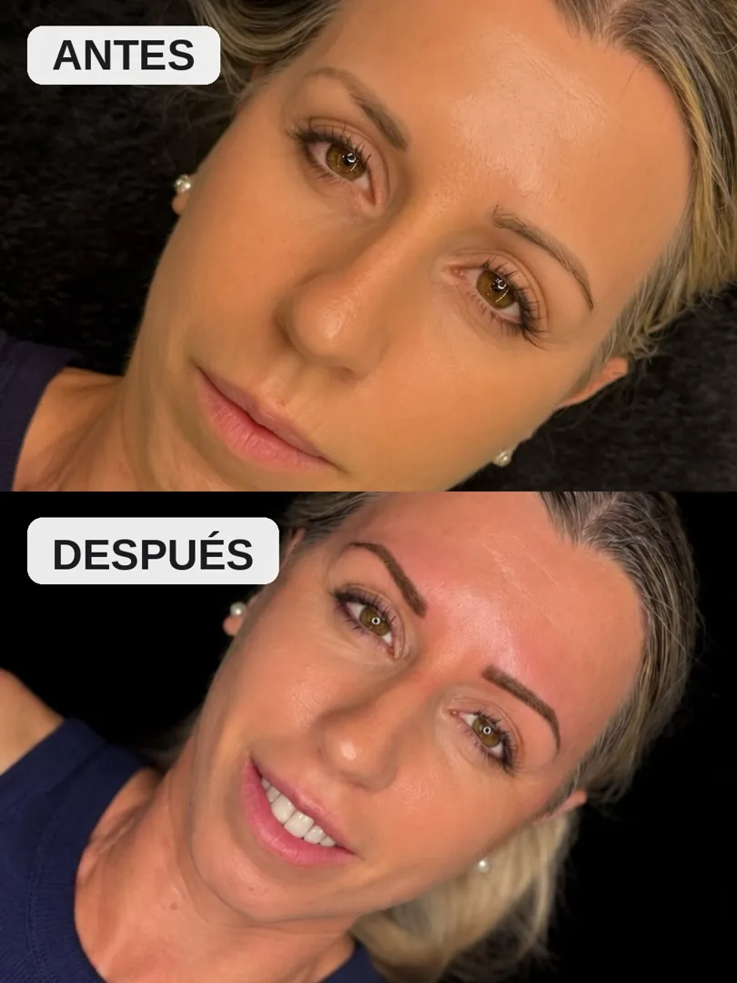 Antes y después de cejas, clienta 4